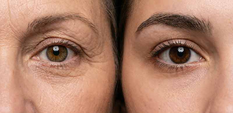 Hinokitiol-for-anti-aging